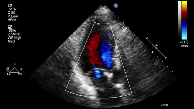 2D Echocardiography Doctor Best 2D Echocardiography Doctor in Navi Mumbai