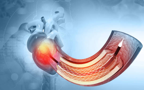 interventional cardiologist best interventional cardiologist in navi mumbai